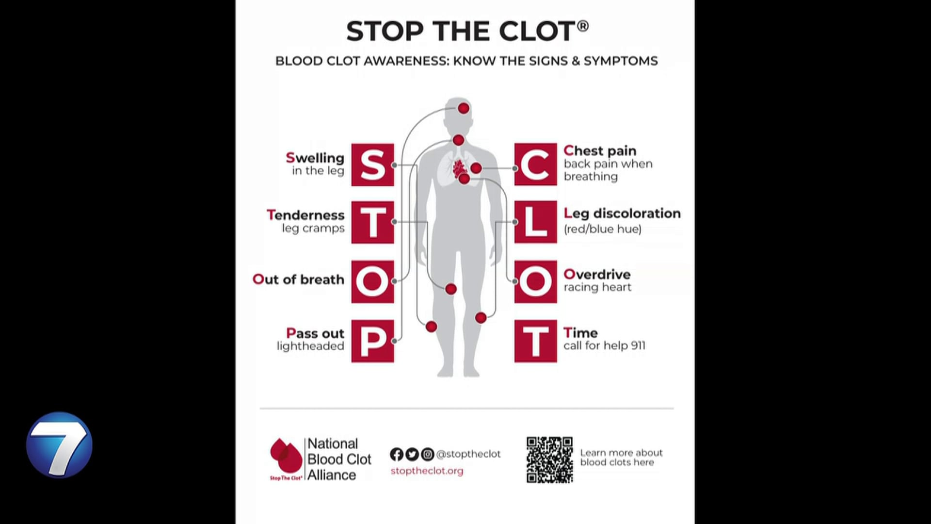 Blood clots: Hot topic of conversation after Jalen Hurts’ diagnosis