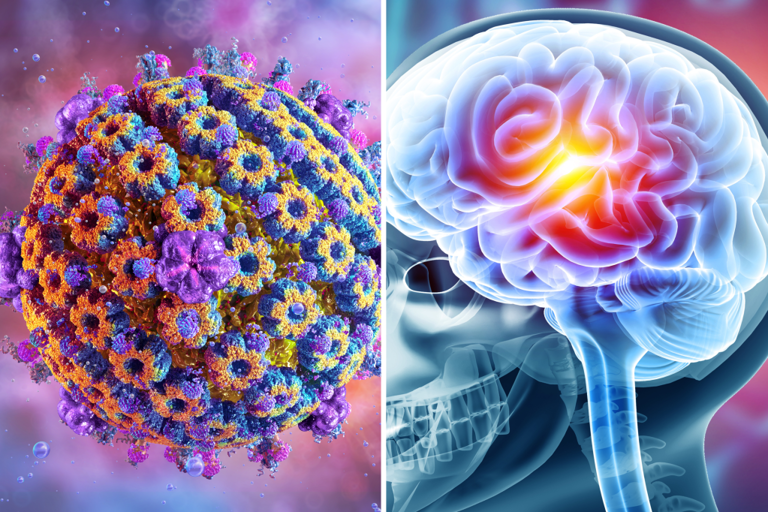 Virus affecting 60 percent of people may hold clues to Alzheimer's risk