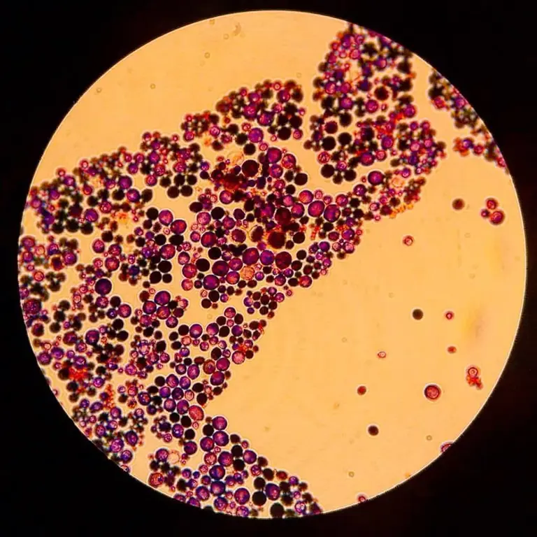 Scientists discover a bacterial molecule that tricks deadly fungi into ...