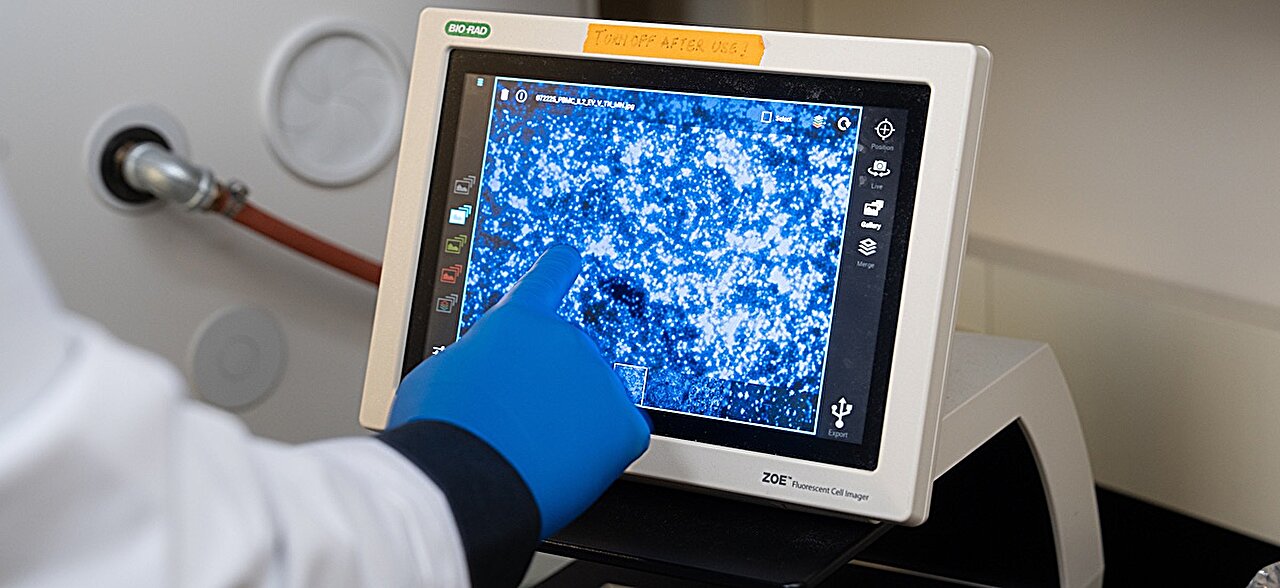 T cell survival protein controls gene activity, offering clues to HIV ...