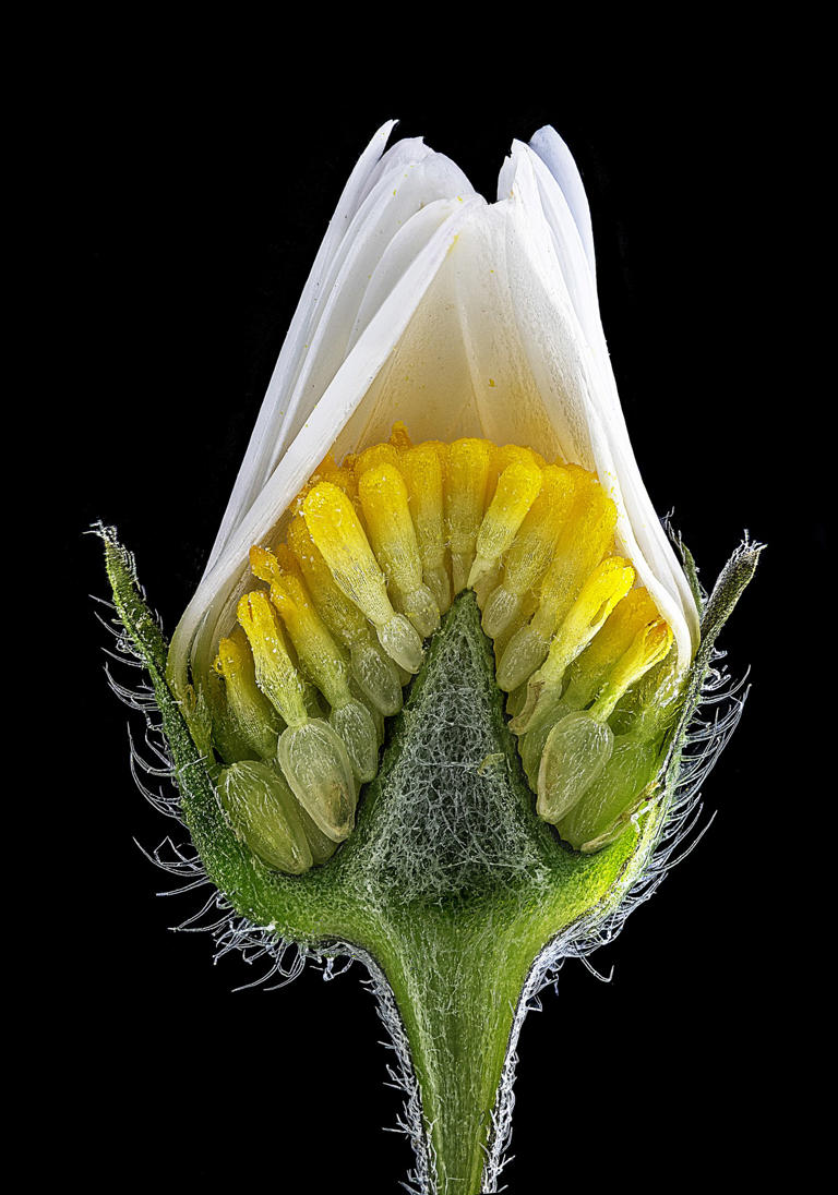 The winner of Nikon’s Small World competition shows the microscopic ...
