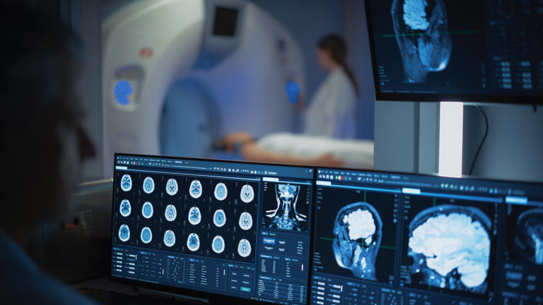 Alzheimer być może zaczyna się poza mózgiem. Nowy trop daje nadzieję na ...