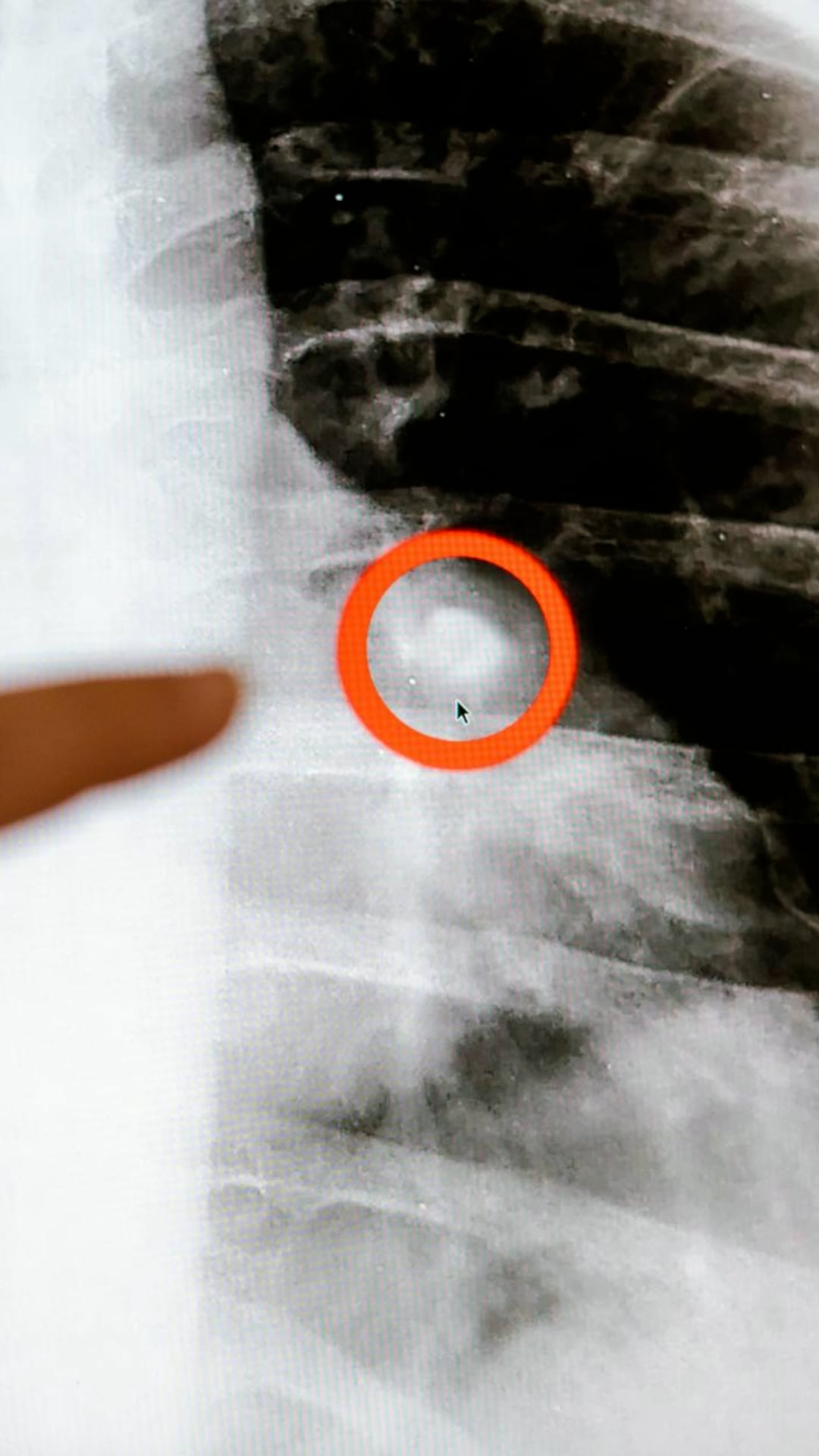5 habits to prevent the leading cause of cancer deaths