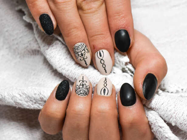 Don't ignore your nails: which ridges are normal and which need a doctor