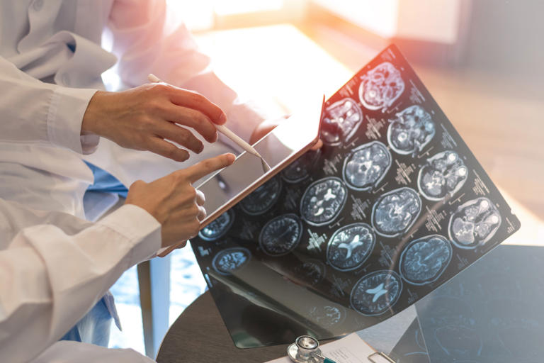Mental health predicted by child brain development, new study finds