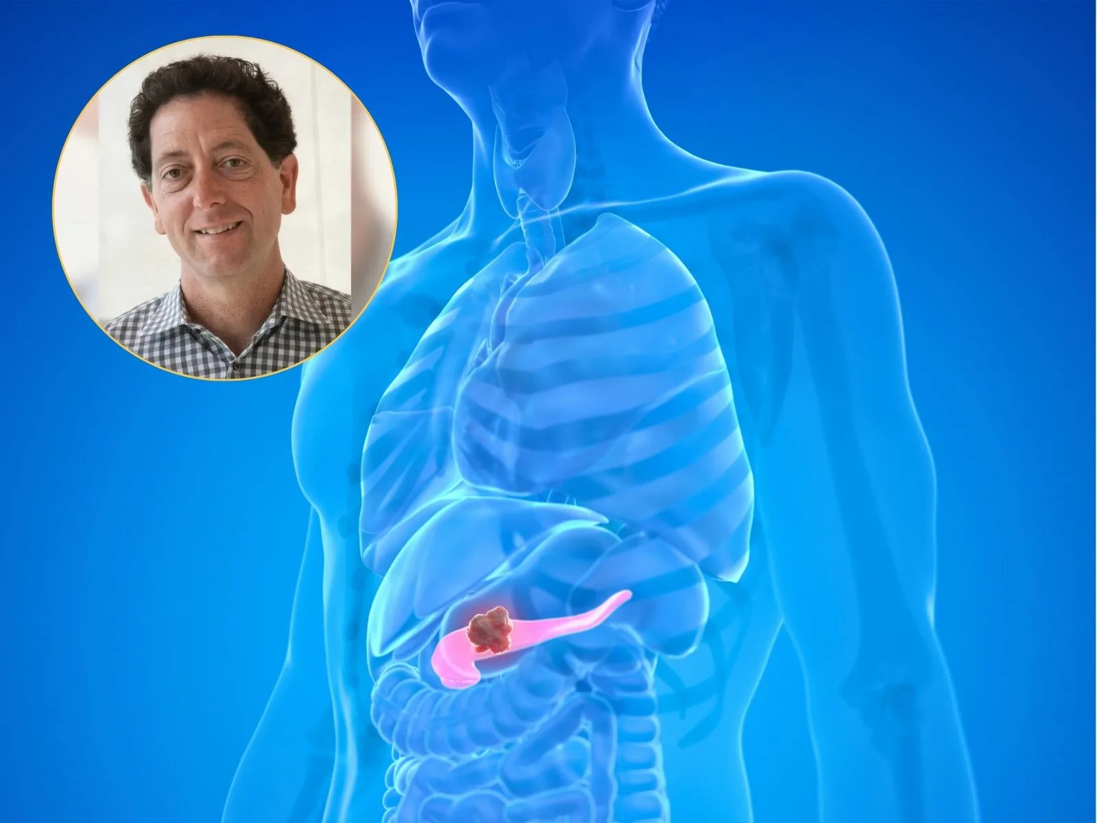 Scientist who cracked ‘undruggable’ cancer gene wins $1 million prize