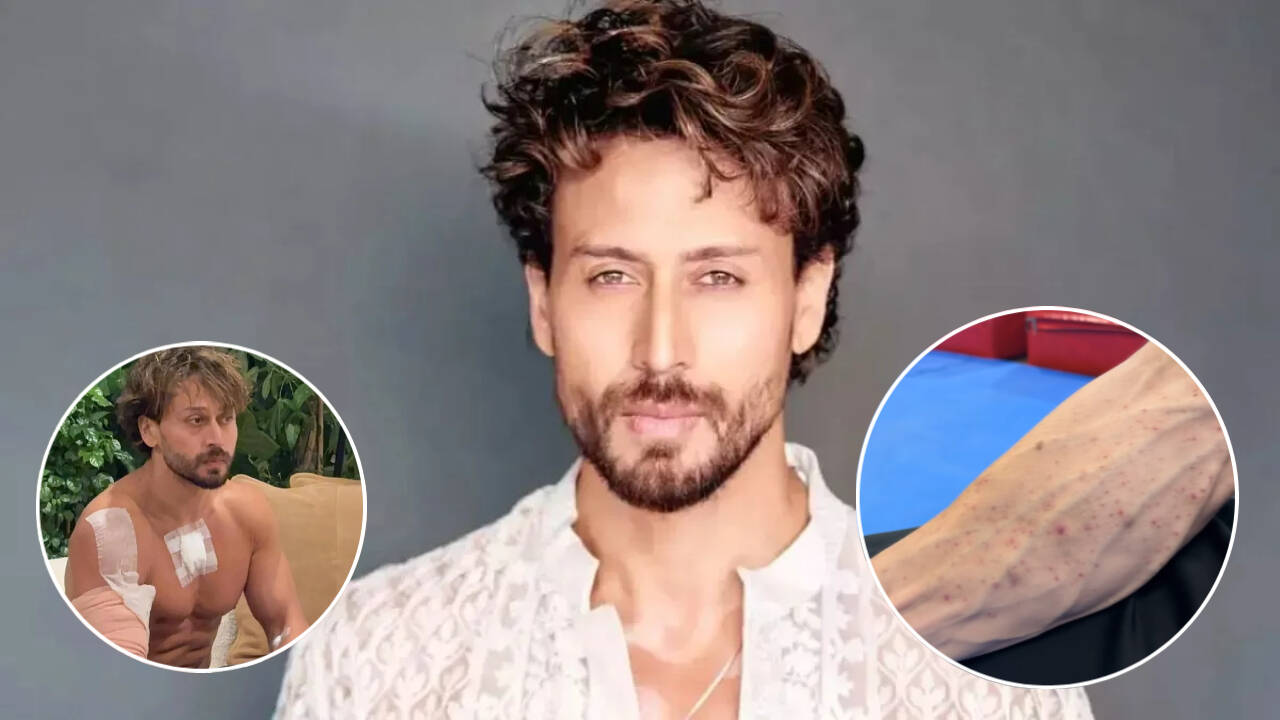 Tiger Shroff's team shares video of gunpowder burn marks on his hand ...