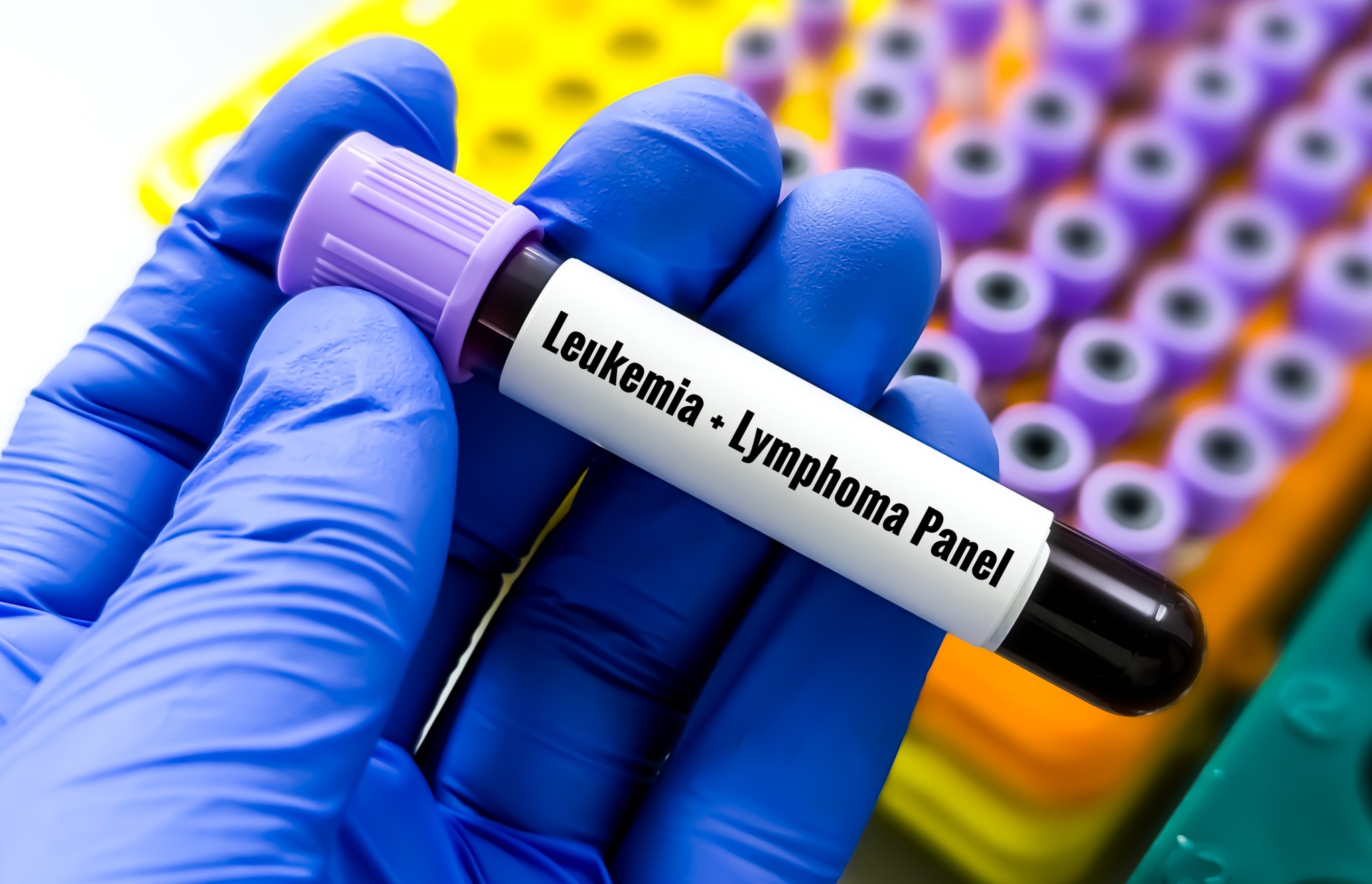 Scientists tested vitamin C in people at risk of leukemia. One finding ...