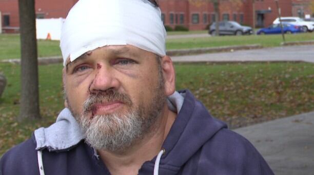 Potsdam man recovering after being hit by vehicle