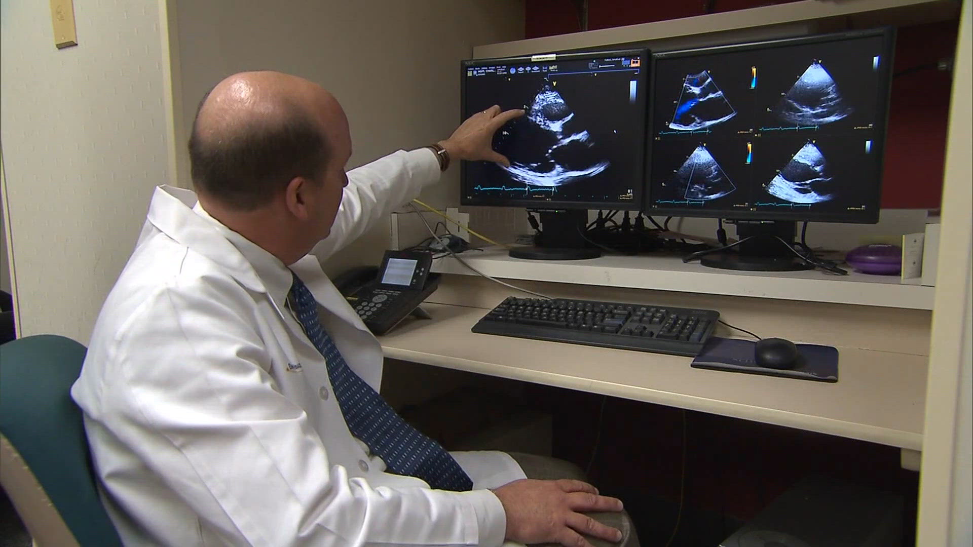 Irregular heartbeat symptoms: When should you seek help?