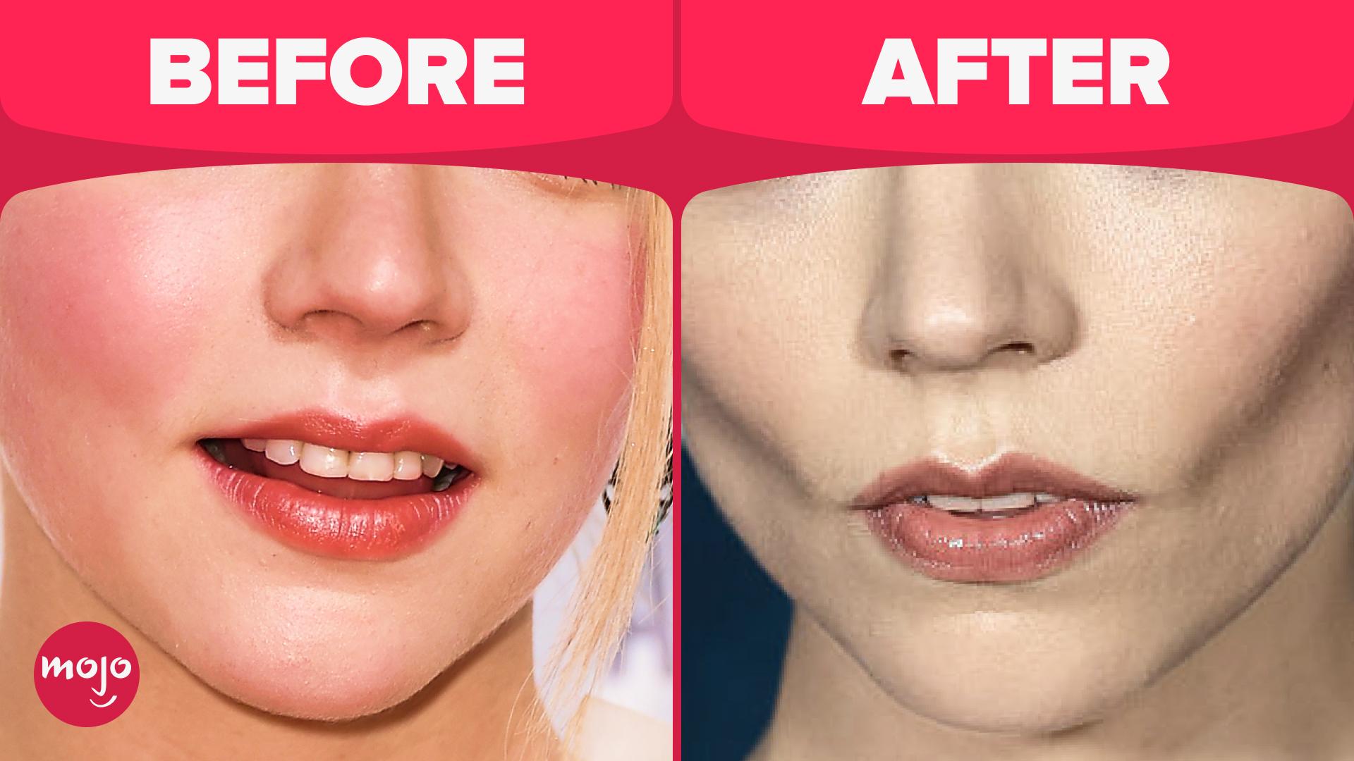 Top 10 worst cosmetic surgery trends today