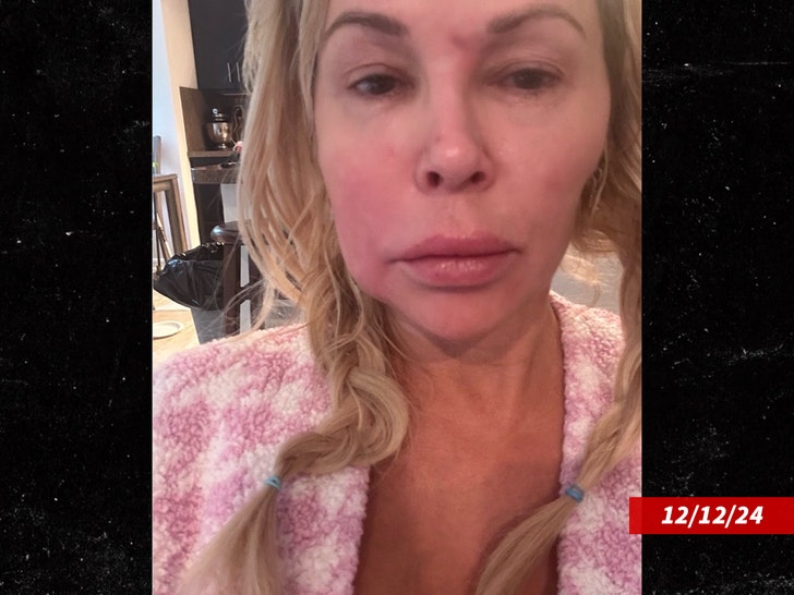 Brandi Glanville undergoing surgery to remove facial gunk and organisms