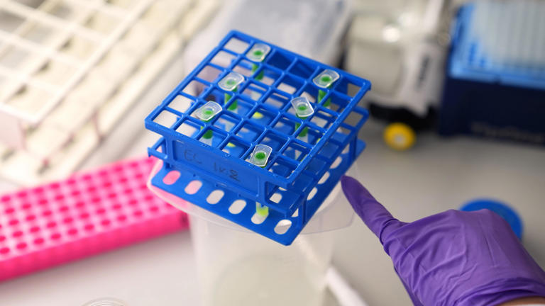 AI could supercharge fight against cancer, researchers say