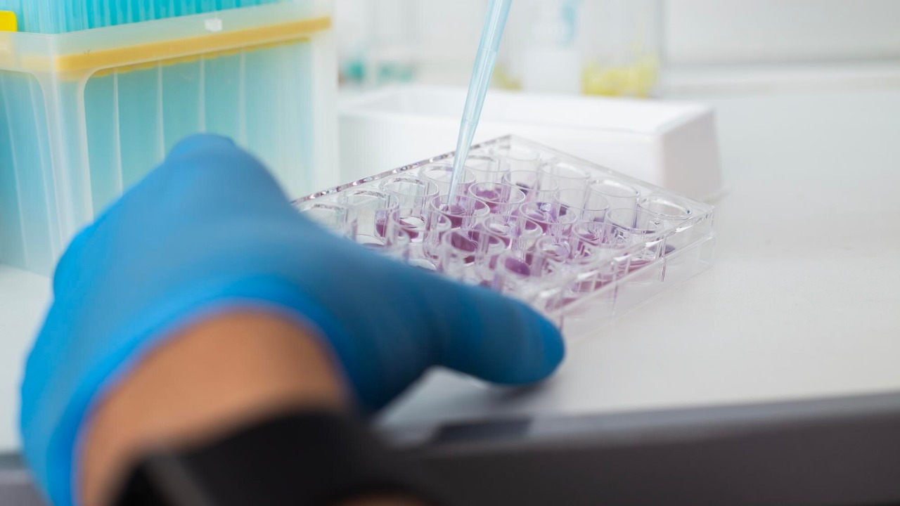 Scientists turned an 80-year-old’s blood cells into neural stem cells ...