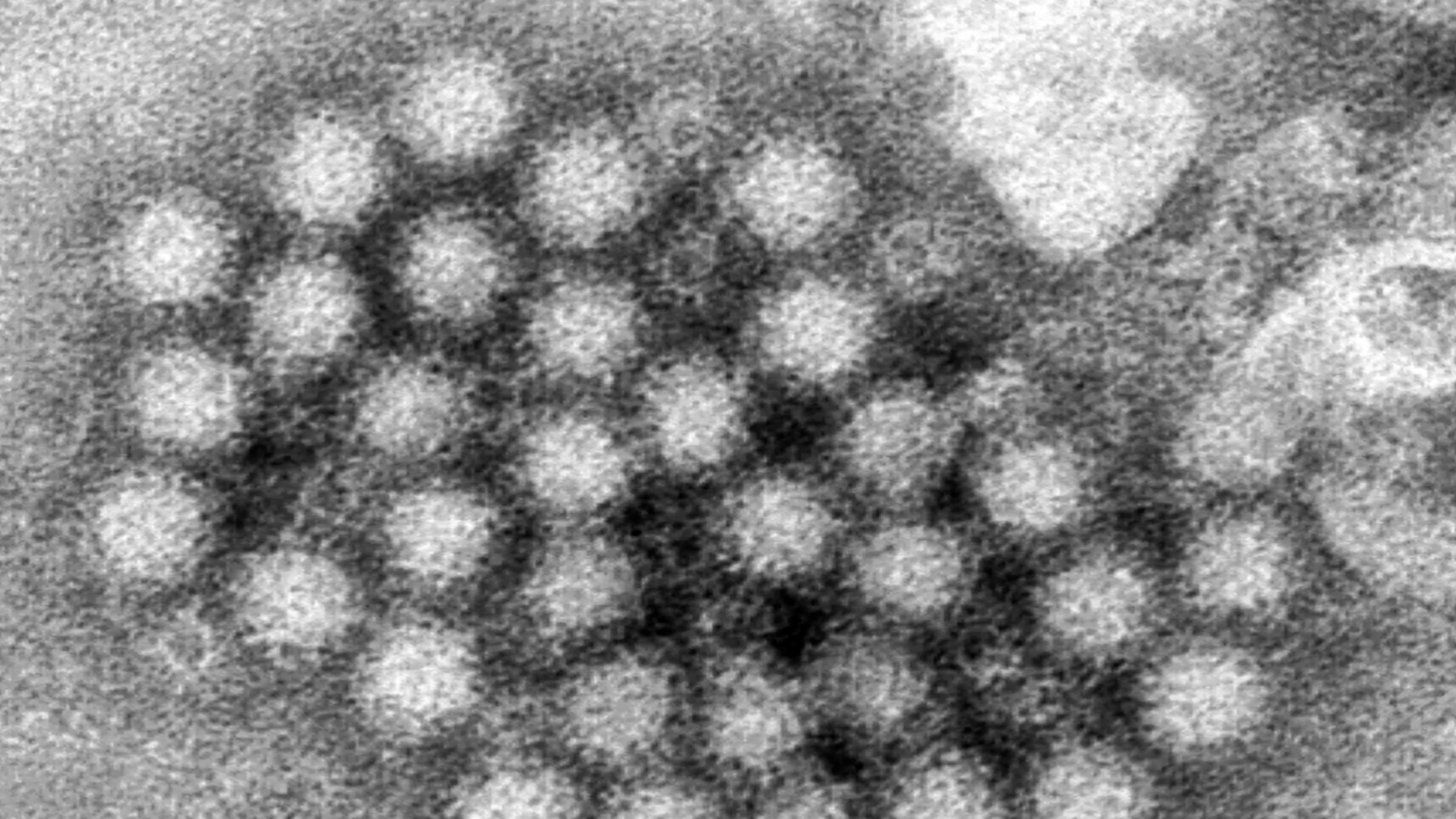 Nearly 100 cases of norovirus reported at Kansas elementary school ...