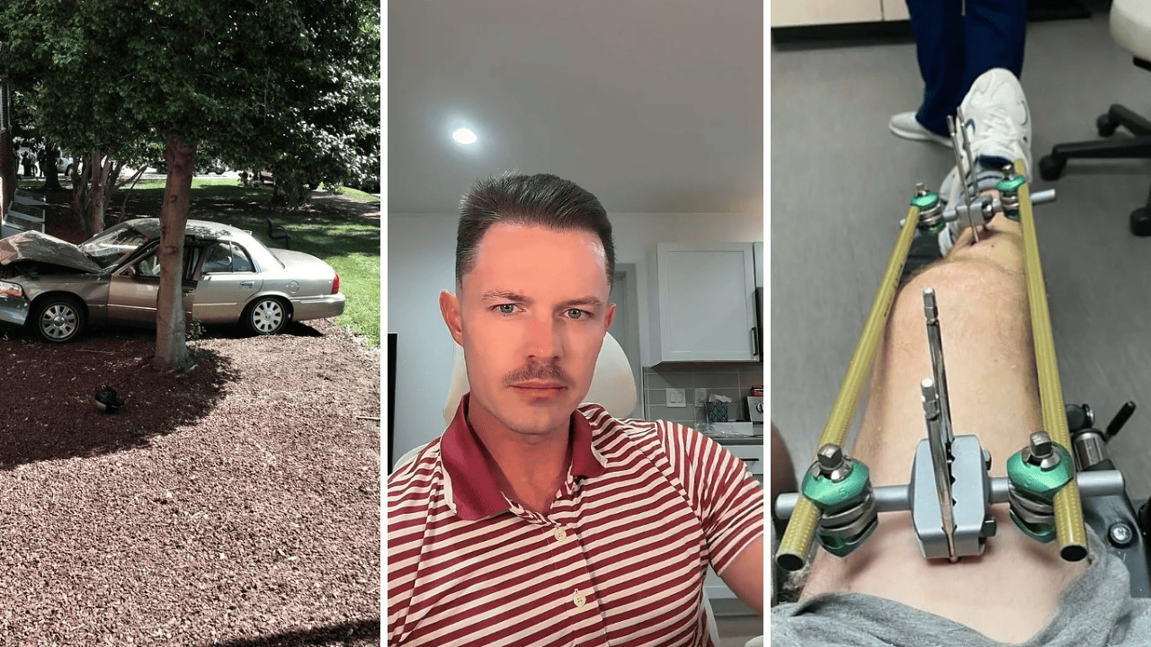 Arizona man slammed into a tree during a seizure. Then, he was ...