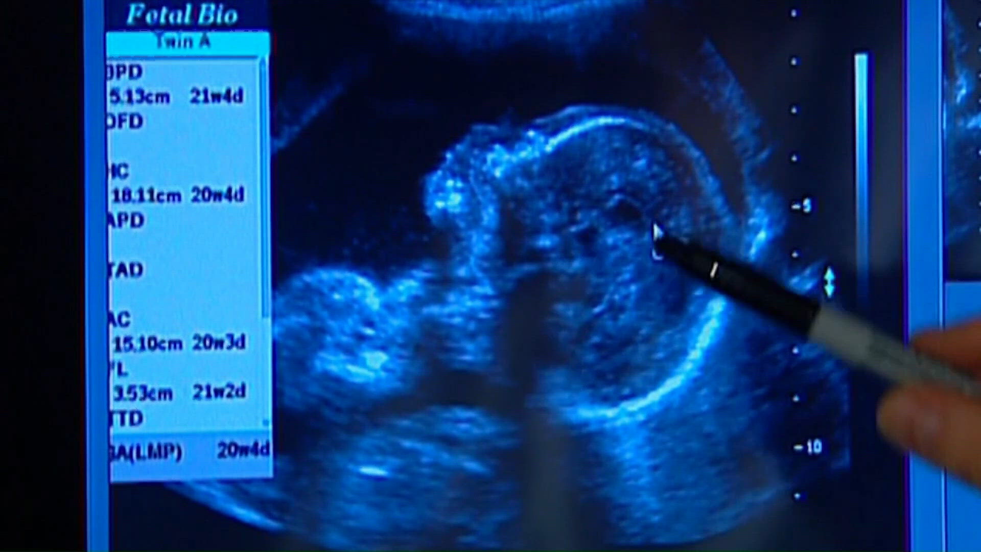 How chronic stress during pregnancy can affect child brain development