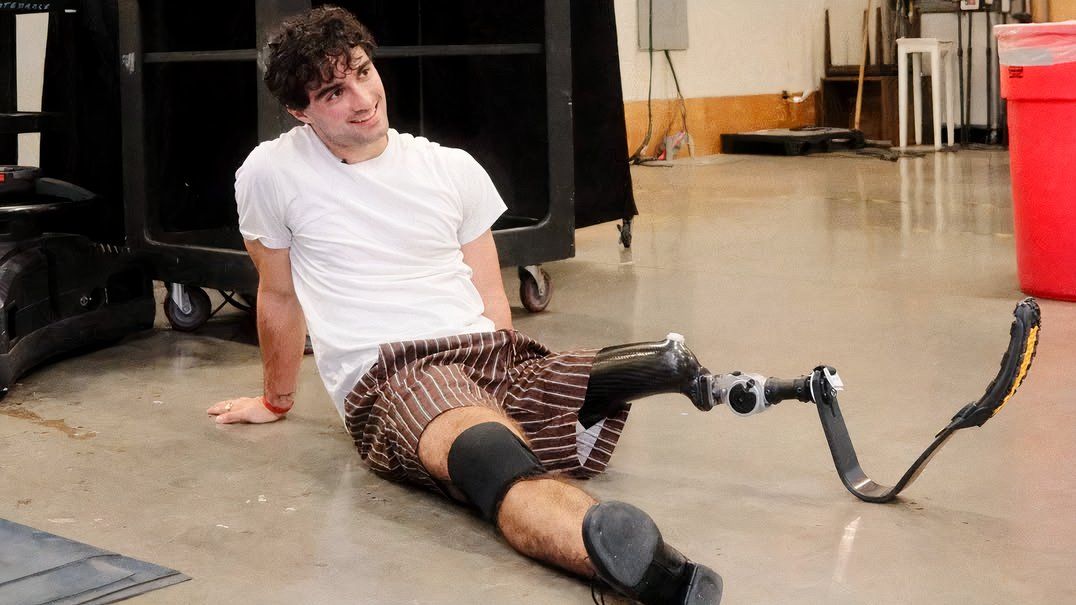 'DWTS' star Ezra Frech has a nickname for his stump -- but not his ...