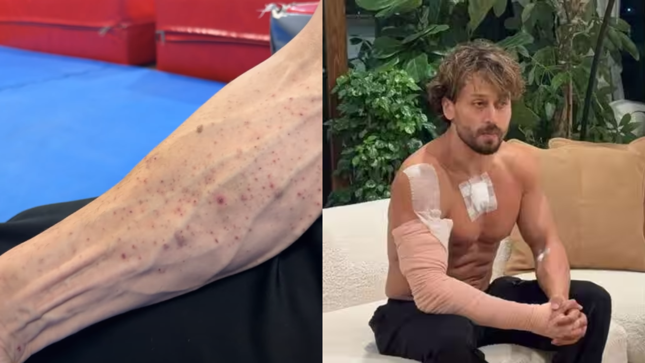 Video shows injury marks: Tiger Shroff team shares clip after firing ...