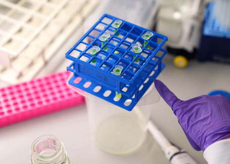 AI could supercharge fight against cancer, researchers say