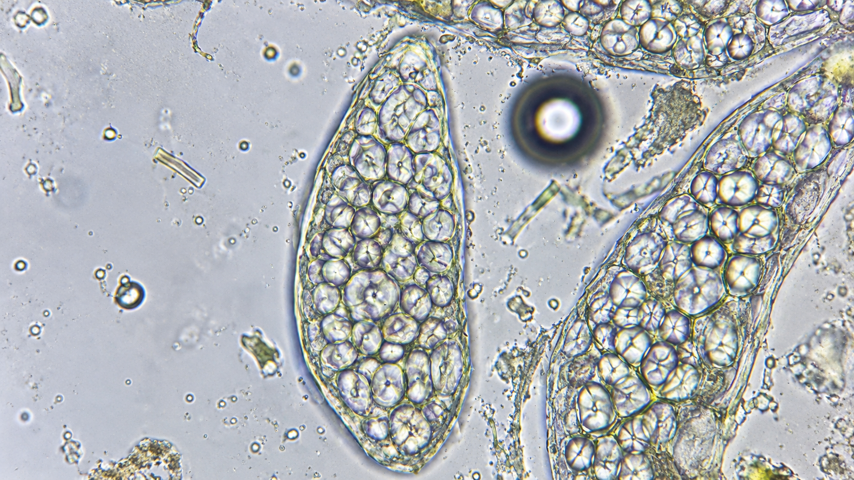 A closer look at tiny organisms, plant cells, food, and common ...