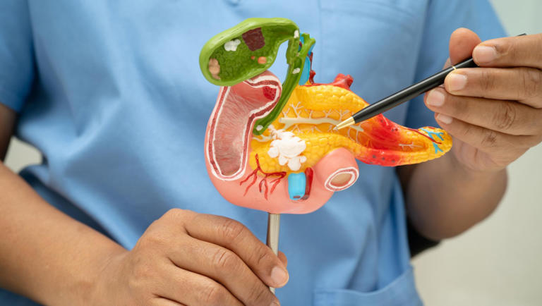 Nuove terapie per tumore al pancreas raddoppiano la sopravvivenza