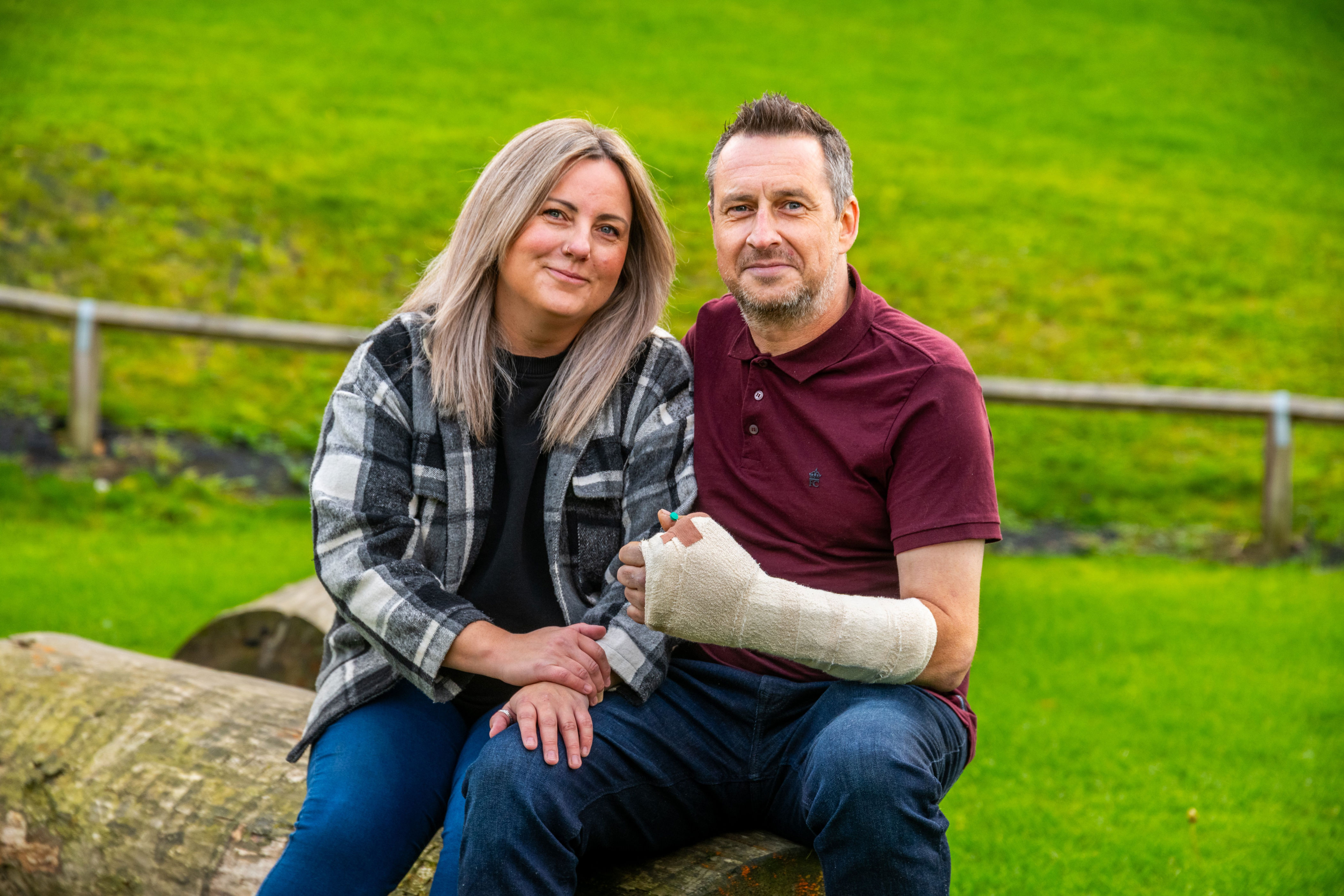 Harrogate man hails 'phenomenal' surgeons for reattaching severed thumb ...