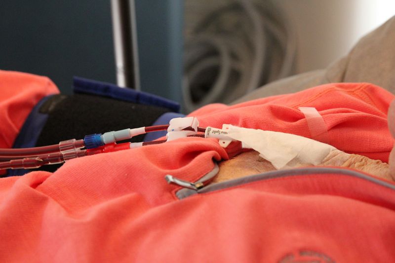 Vor Bio says its experimental drug slowed loss of kidney function in ...