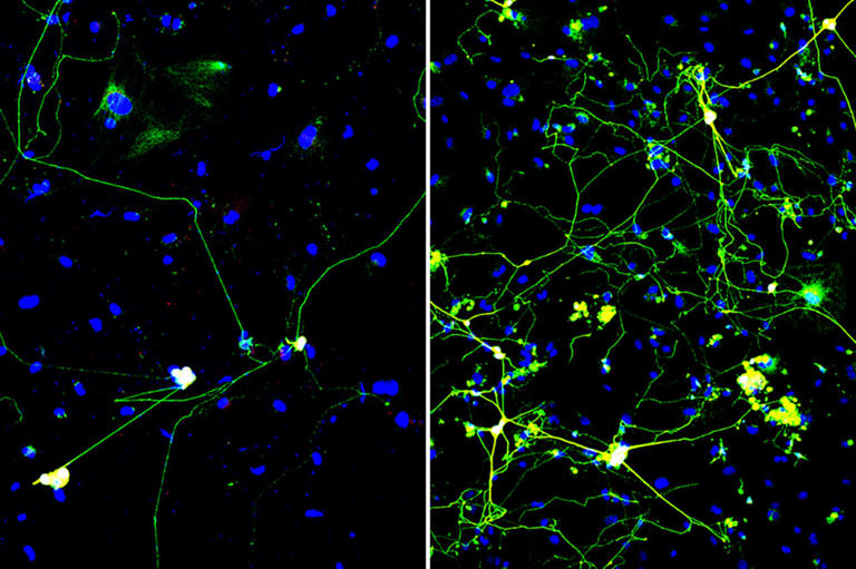 A quick squeeze helps CRISPR turn skin cells into neurons more efficiently