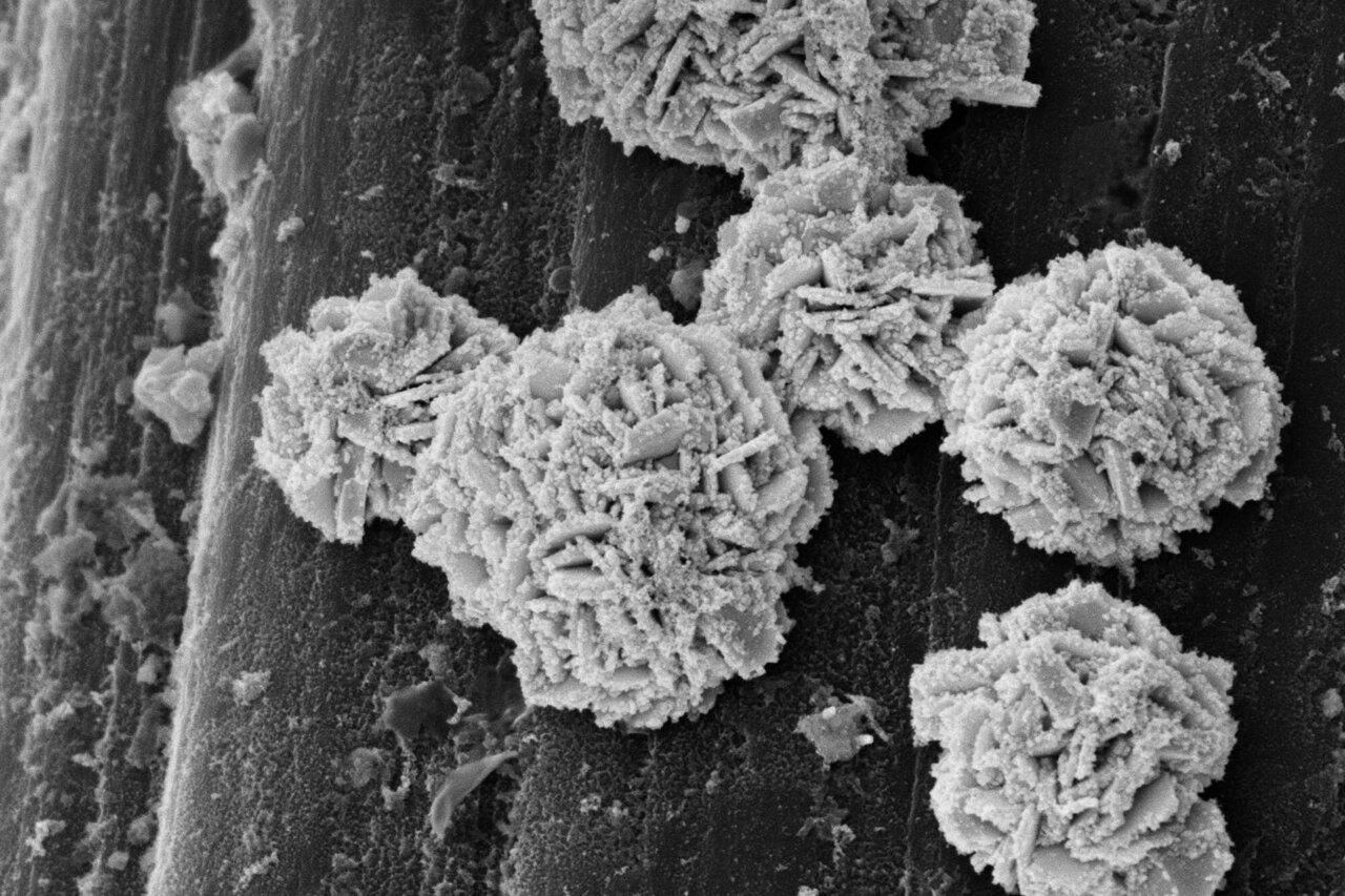 Tackling diabetes with an electronic implant: How a tiny catalyst ...