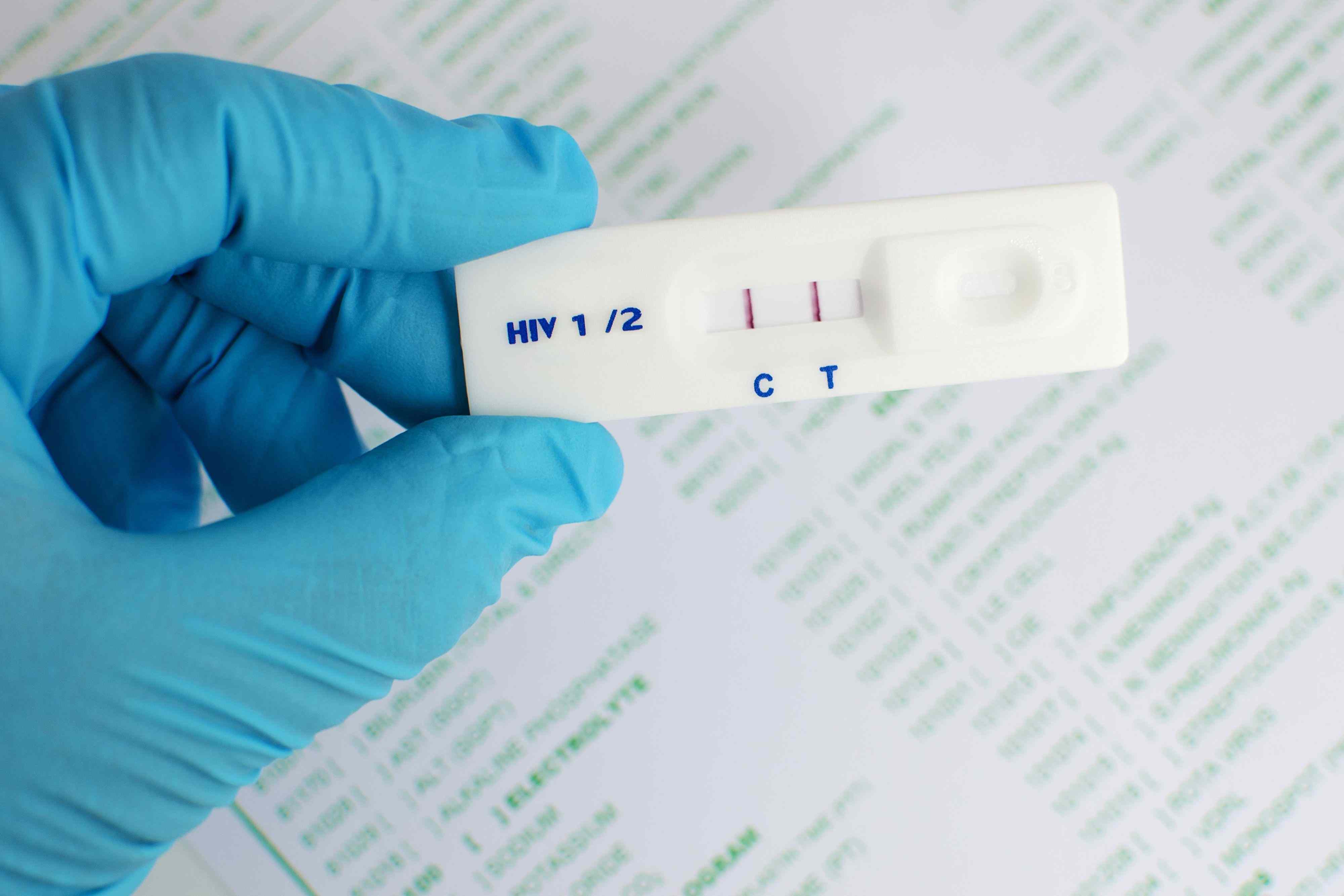 What happens when you get tested for HIV?