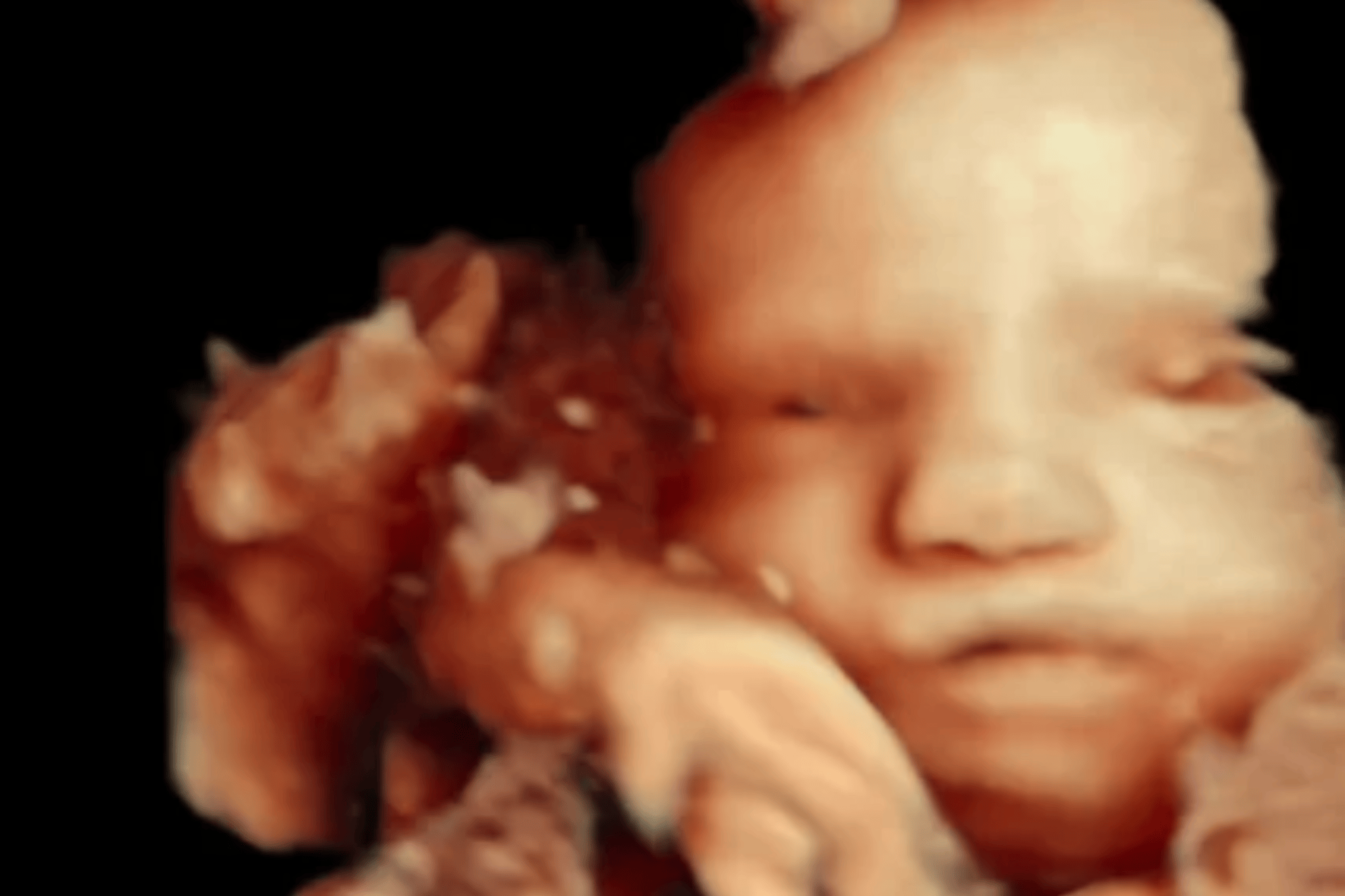Mom loves seeing baby’s eyes open on scan, then comes heartbreaking truth