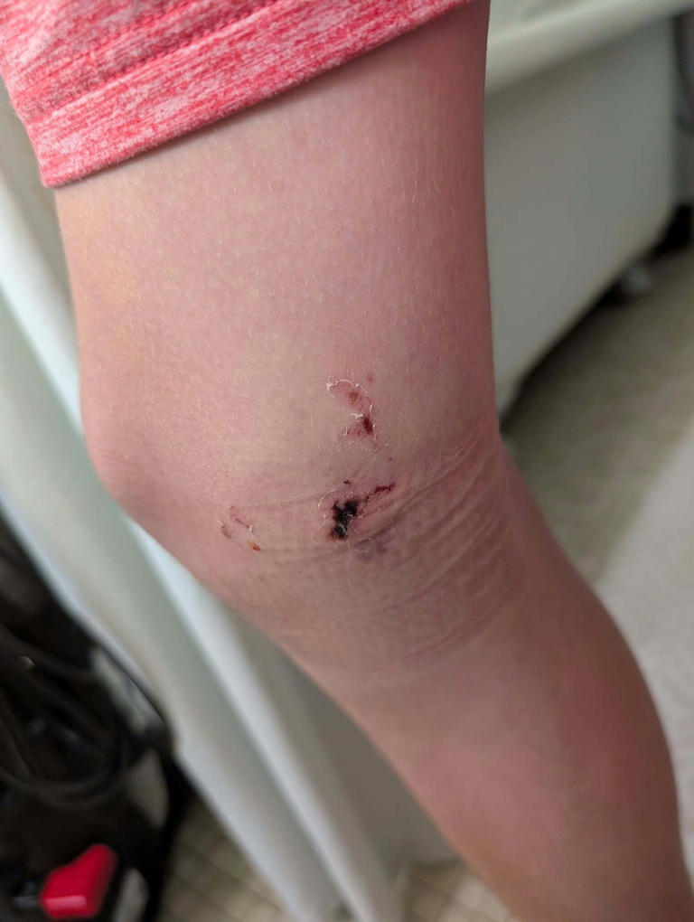 Oshkosh mom asks neighbors to check doorbell cameras after dog bites son
