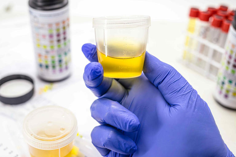 How kidney disease is diagnosed