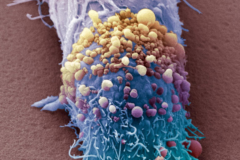 Personalised cancer vaccine expected to be approved next year