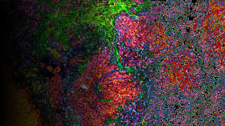 Open-source workflow makes spatial proteomics easier to use