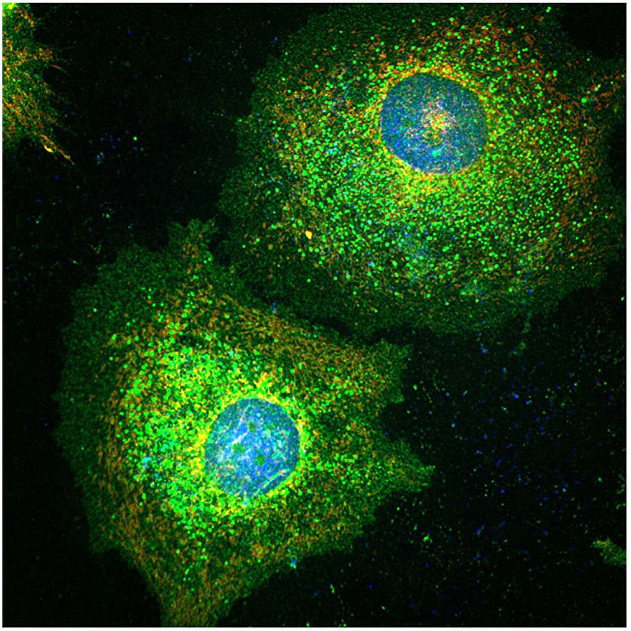 How cancers evade chemotherapy by entering a 'zombie-like state'