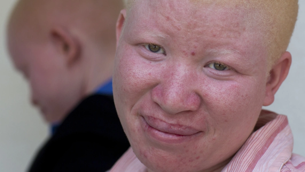 BBC Wildlife details rare albino animals and their survival odds