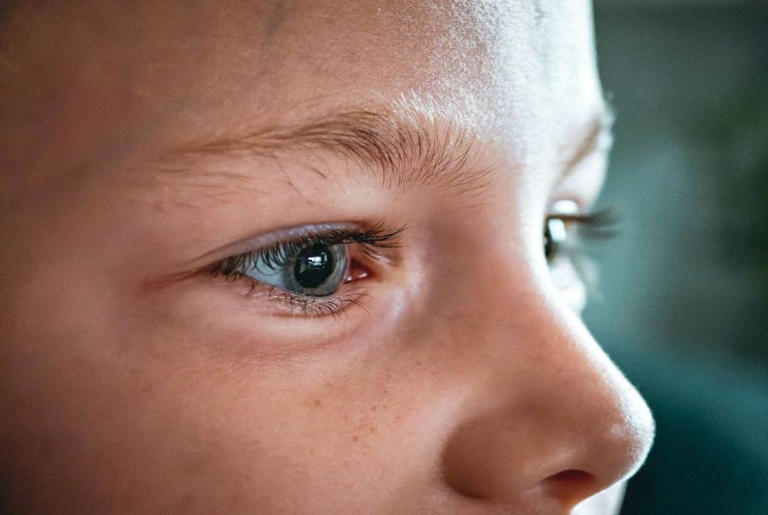 What if your child thinks blurry vision is normal?
