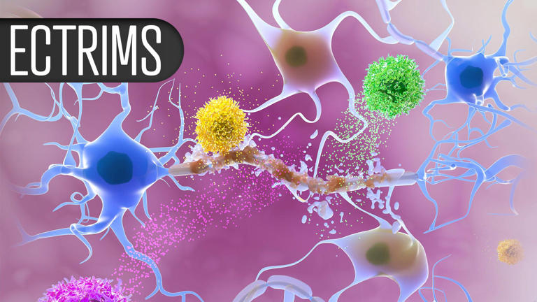Multiple sclerosis anti-CD20 drug linked to bowel disease risk