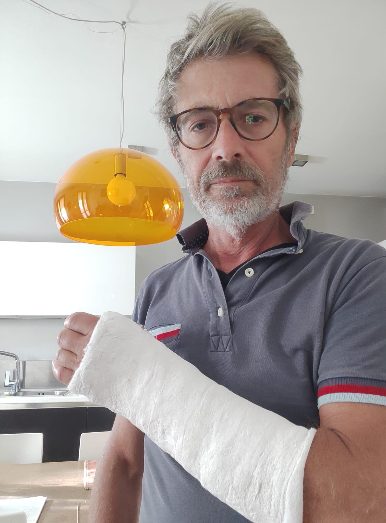 Cade in bici sulla ciclabile e si rompe il polso. Claudio Orazi cerca l ...