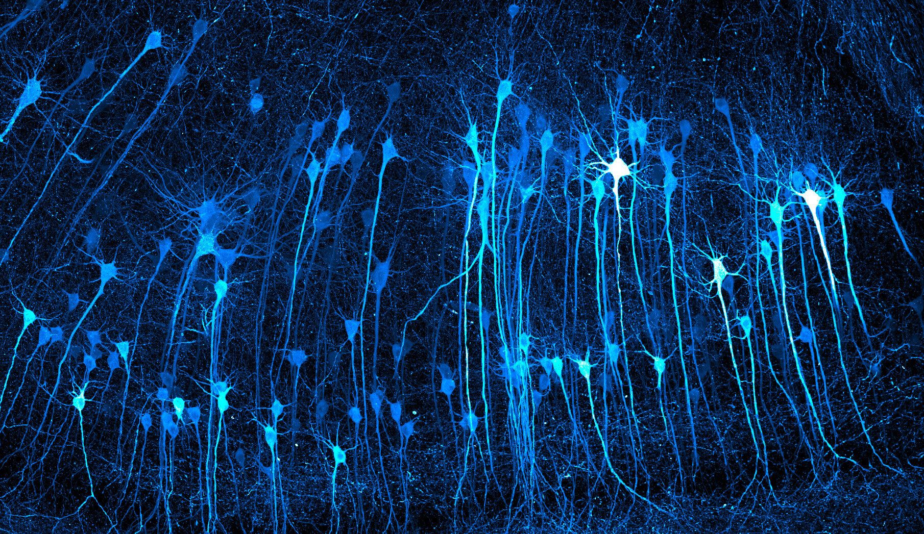 These glowing neurons look like an alien forest at night, but you're ...