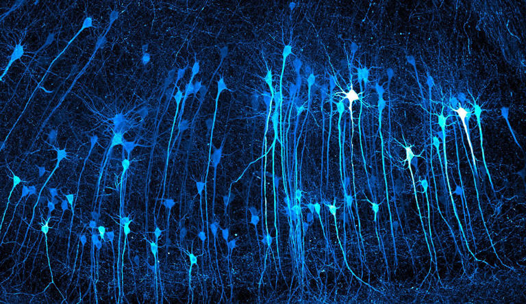 These glowing neurons look like an alien forest at night, but you're ...