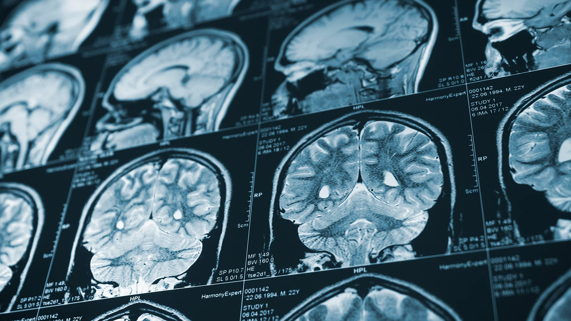 Your aging brain isn’t just declining. Scientists say forgetting ...
