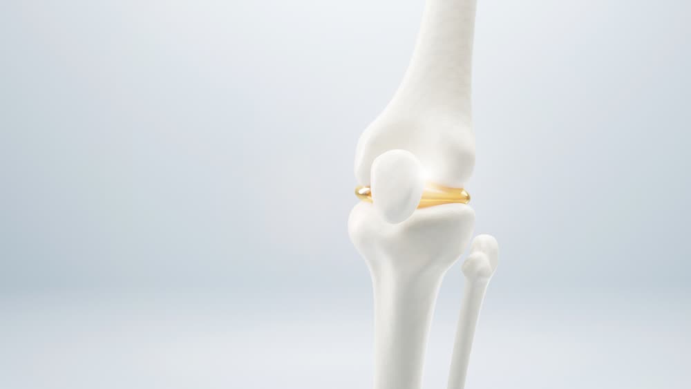 Hidden bone disease affects 40 percent of adults worldwide – are you ...
