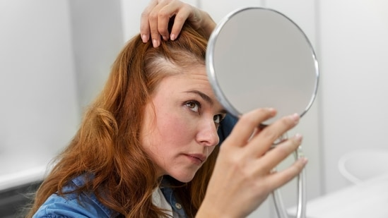 Menopause and hair fall: Link between hormones, nutrition and hair ...