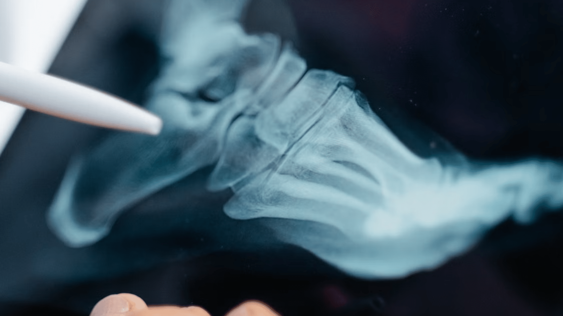 A 10-year bone health study looked at tea and coffee. One drink ...