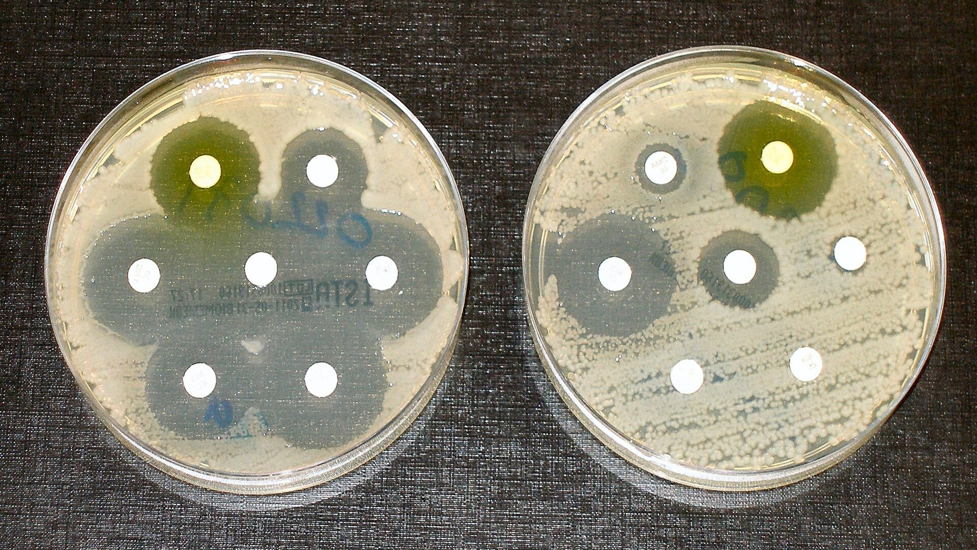 Scientists uncover how insect-killing bacteria could lead to new ...