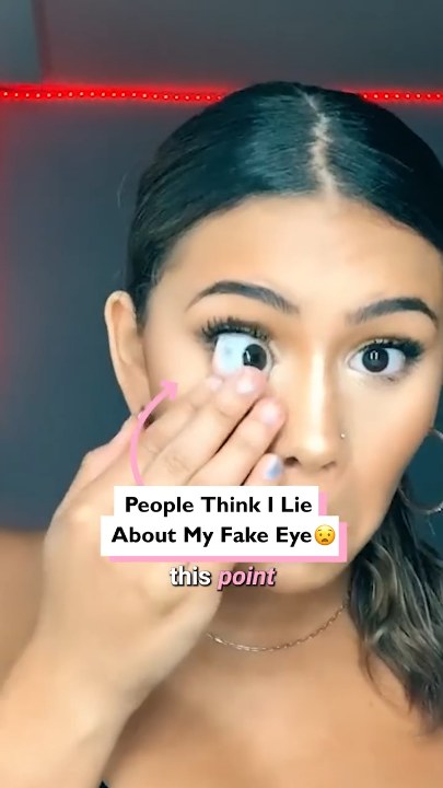 People say I'm lying about my fake eye