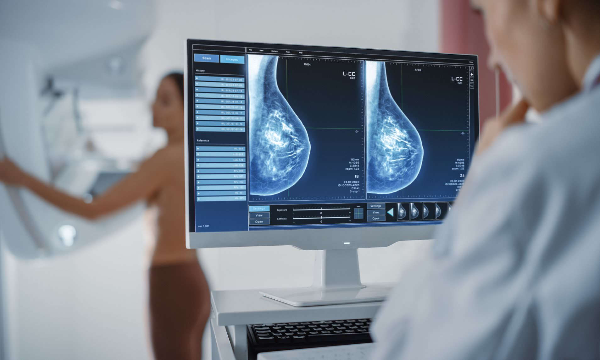 Genetic test may spare younger women chemotherapy for breast cancer
